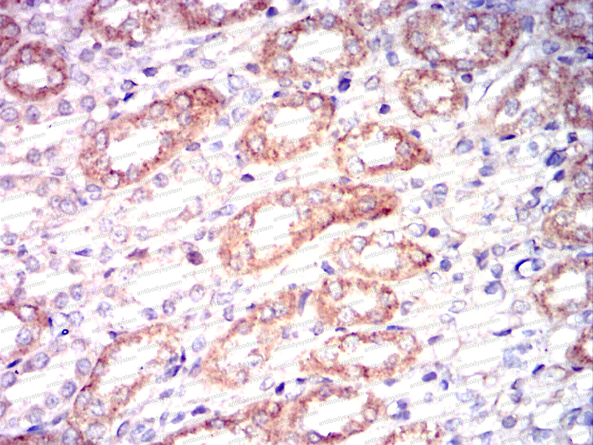 Валидация AntibodySystem RHD38803