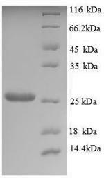 SDS-PAGE