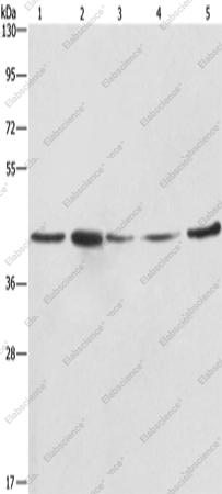 Вестерн-блоттинг, RPSA, клетки A549, NIH/3T3, 293T, HeLa и ткань гепатоцеллюлярной карциномы человека