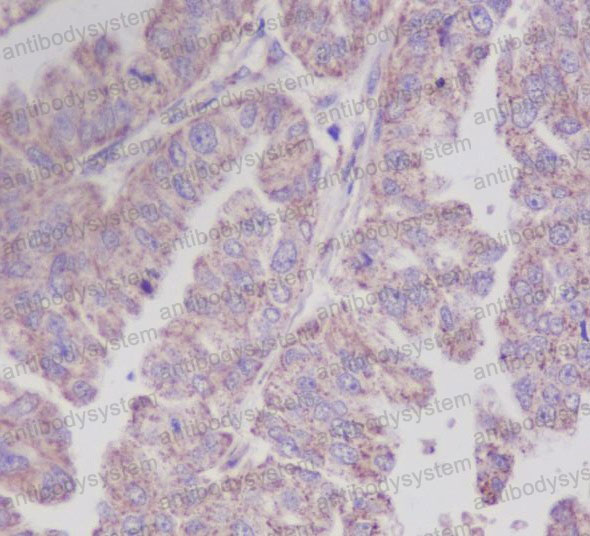 Валидация AntibodySystem RHD87202