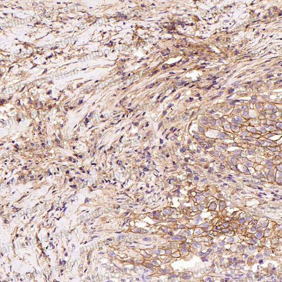 Валидация AntibodySystem RHF12201