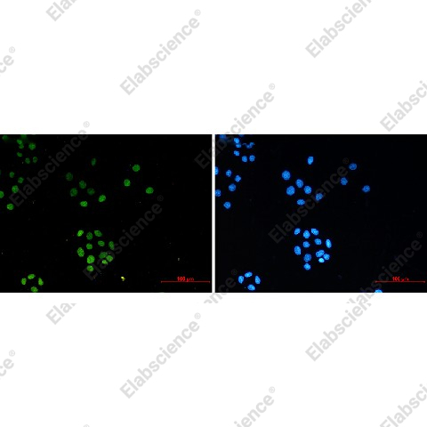 Иммунофлуоресценция, TriMethyl-Histone H3 (Lys27), клетки HeLa