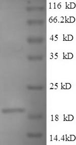 SDS-PAGE