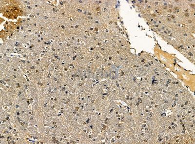 Валидация Affinity DF14297 - 10175