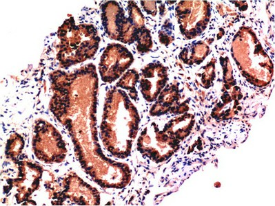 Валидация Elabscience E-AB-22213