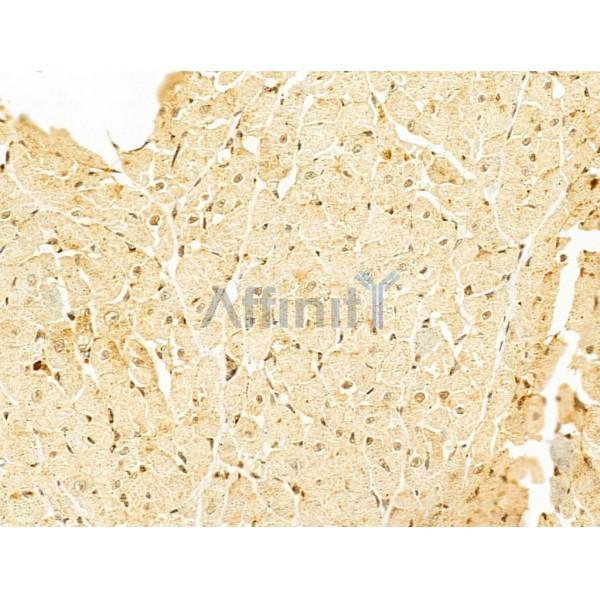 Валидация Affinity DF12500 - 7081