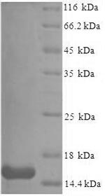 SDS-PAGE