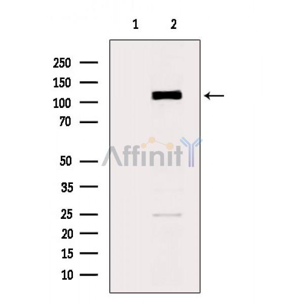 Валидация Affinity DF6536 - 17963