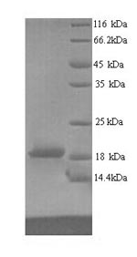 SDS-PAGE