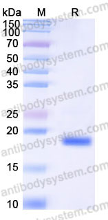 AHC15801, SDS-PAGE