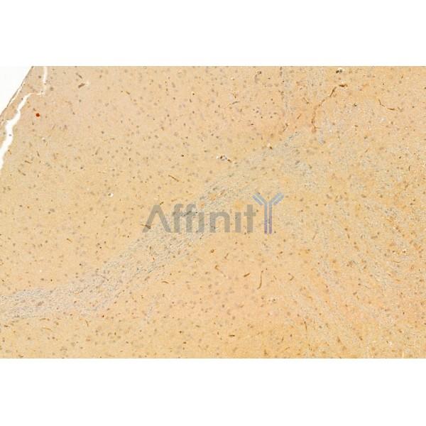 Валидация Affinity AF6284 - 3544