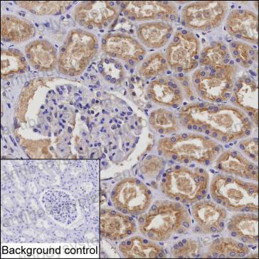 Валидация AntibodySystem RHE70901