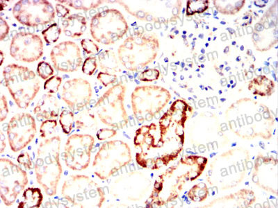 Валидация AntibodySystem RHC33503