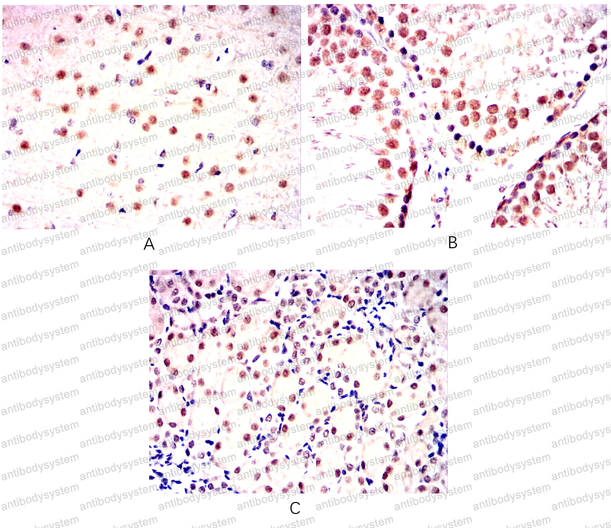 Валидация AntibodySystem RHF42902 (2510)