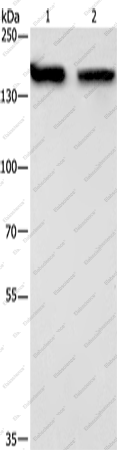 Вестерн-блоттинг, NCAPD2, клетки 293T и HeLa
