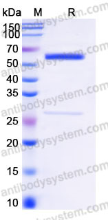 AHD34001, SDS-PAGE