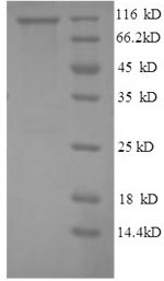 SDS-PAGE