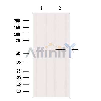 Валидация Affinity AF6004 - 3188