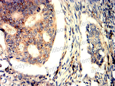 Валидация AntibodySystem RHD03801