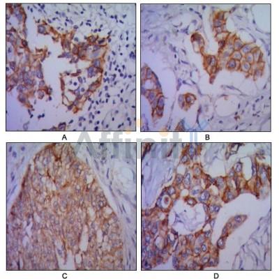 Валидация Affinity BF9214 - 5428