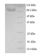 SDS-PAGE
