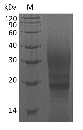 SDS-PAGE