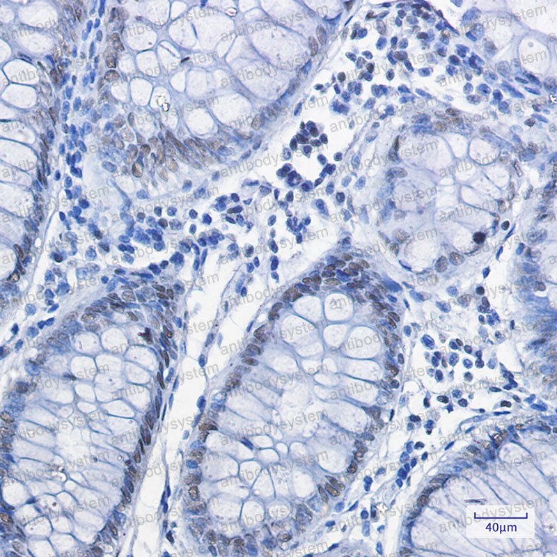 Валидация AntibodySystem RHJ37102