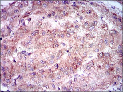 Валидация AntibodySystem RHC38602