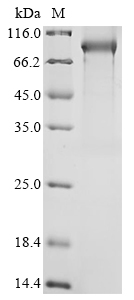 SDS-PAGE