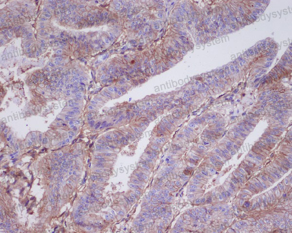 Валидация AntibodySystem RHG62602