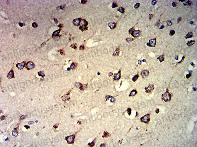 Валидация AntibodySystem RHD62203