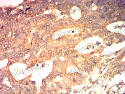 Валидация AntibodySystem RHG13211