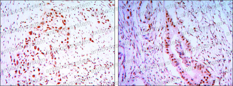 Валидация AntibodySystem RHD87702