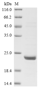 SDS-PAGE
