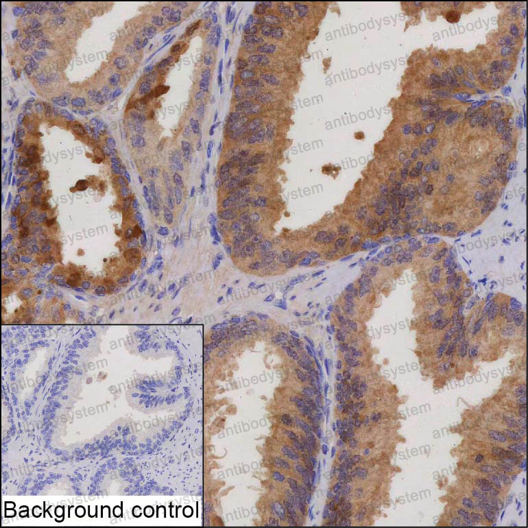 Валидация AntibodySystem RHG02702