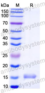 Валидация SDS-PAGE - AntibodySystem RVV02823