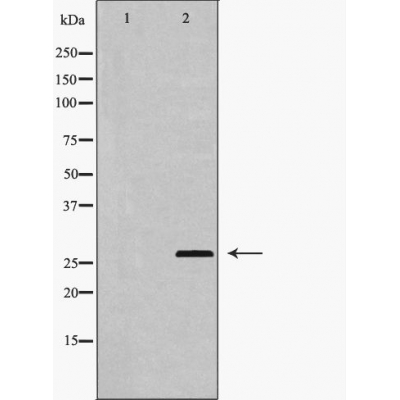 Валидация Affinity DF6043 - 17260