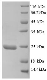SDS-PAGE