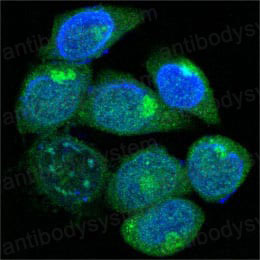 Валидация IF - AntibodySystem RHN91101