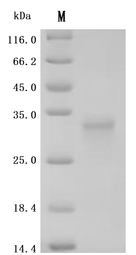 SDS-PAGE