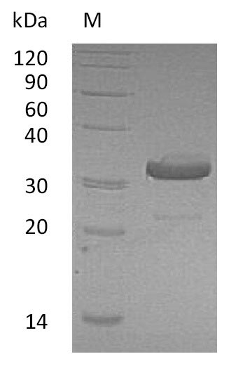 SDS-PAGE