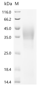 SDS-PAGE