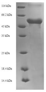 SDS-PAGE