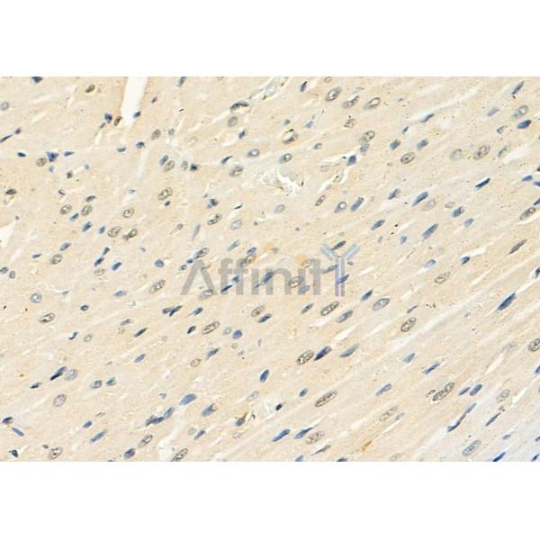 Валидация Affinity DF8913 - 21043