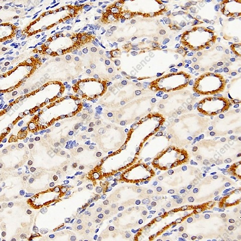 Иммуногистохимия, Mineralocorticoid receptor, ткань почки крысы