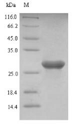 SDS-PAGE