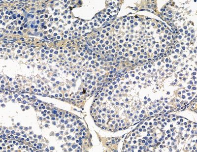 Валидация Affinity DF15355 - 11658