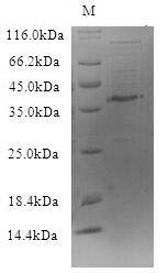 SDS-PAGE