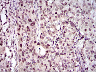 Валидация AntibodySystem RHC91302 (1171)