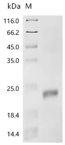 SDS-PAGE